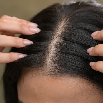 Steps to Keep Dandruff at Bay