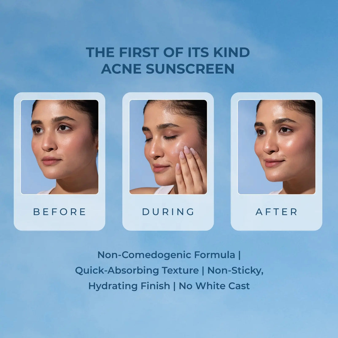 Naturali Acne Control Sunscreen With Tea Tree Oil, Hemp Oil & Salicylic Acid