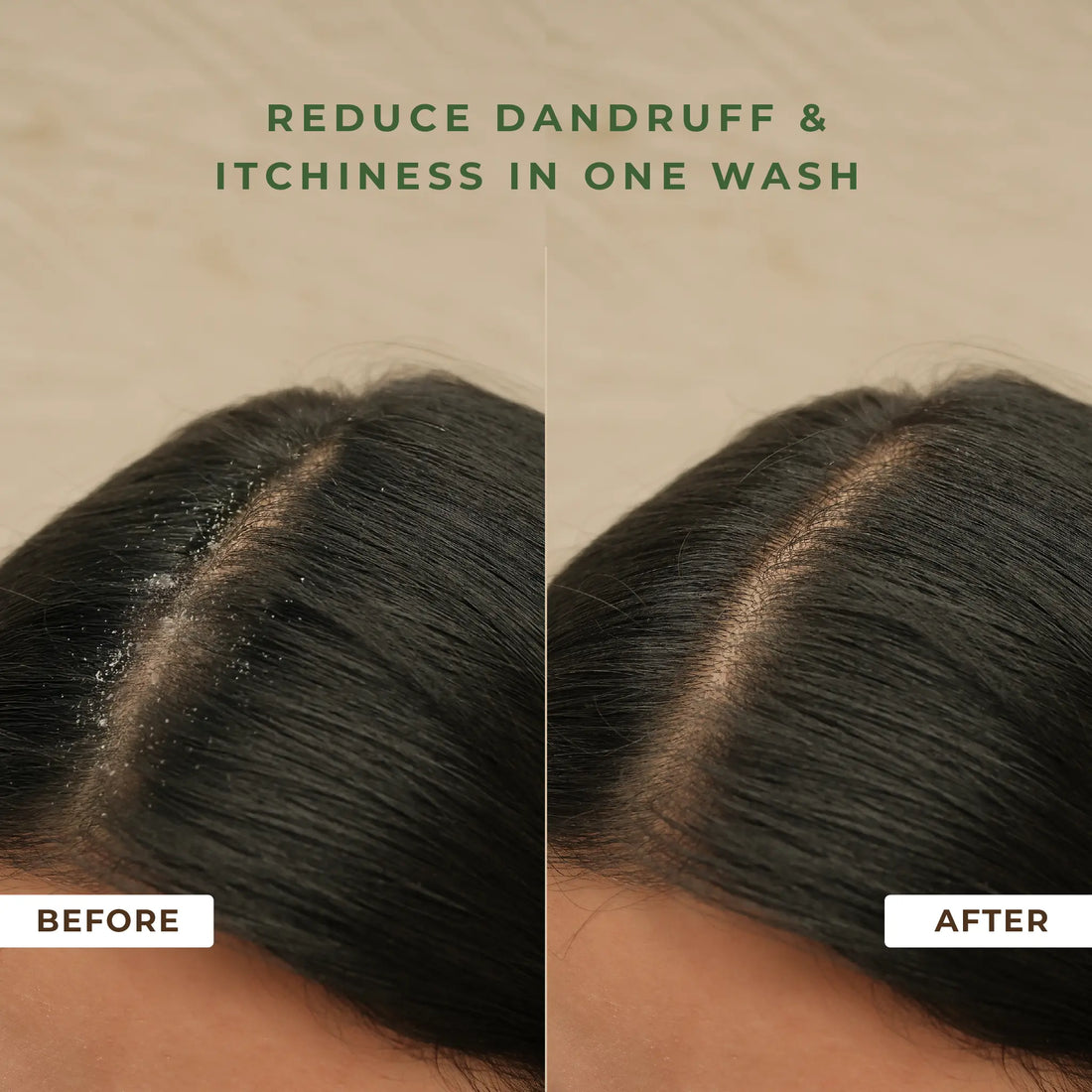 Naturali Dandruff Defence Shampoo 100ml